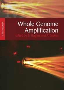 Whole Genome Amplification : Methods Express