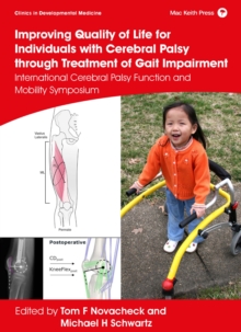 Improving Quality of Life for Individuals with Cerebral Palsy through treatment of Gait Impairment : International Cerebral Palsy Function and Mobility Symposium