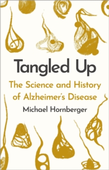 Tangled Up : The History and Science of Alzheimer's Disease