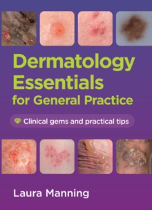 Dermatology Essentials for General Practice : Clinical Gems and Practical Tips