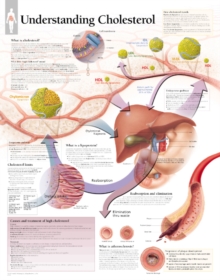 Understanding Cholesterol Paper Poster, Poster Book Understanding Cholesterol Paper Poster, Poster Book