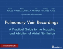 Pulmonary Vein Recordings : A Practical Guide to the Mapping and Ablation of Atrial Fibrillation