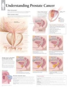 Understanding Prostate Cancer Paper Poster, Wallchart Book Understanding Prostate Cancer Paper Poster, Wallchart Book