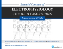 Essential Concepts of Electrophysiology through Case Studies: Intracardiac EGMs : Intracardiac EGMs