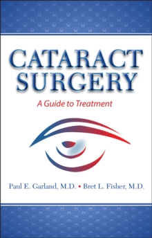 Cataract Surgery