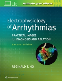 Electrophysiology of Arrhythmias : Practical Images for Diagnosis and Ablation