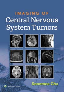 Imaging of Central Nervous System Tumors