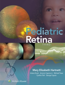 Pediatric Retina