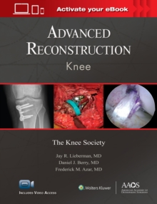 Advanced Reconstruction: Knee: Print + Ebook with Multimedia, Hardback Book Advanced Reconstruction: Knee: Print + Ebook with Multimedia, Hardback Book