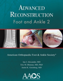 Advanced Reconstruction: Foot and Ankle 2