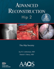 Advanced Reconstruction: Hip 2: Print + Ebook with Multimedia, Paperback / softback Book Advanced Reconstruction: Hip 2: Print + Ebook with Multimedia, Paperback / softback Book