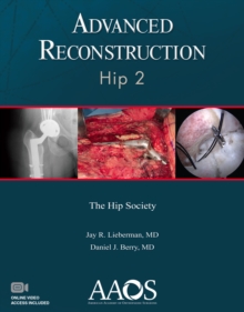 Advanced Reconstruction: Hip 2