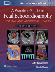 A Practical Guide to Fetal Echocardiography : Normal and Abnormal Hearts