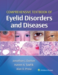 Comprehensive Textbook of Eyelid Disorders and Diseases