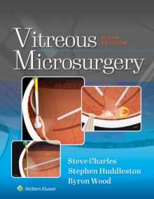 Vitreous Microsurgery