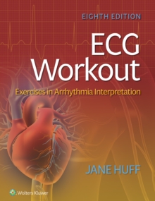 ECG Workout : Exercises in Arrhythmia Interpretation