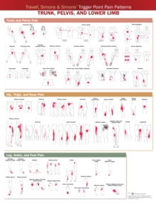 Travell, Simons & Simons Trigger Point Pain Patterns Wall Chart : Trunk, Pelvis, and Lower Limb