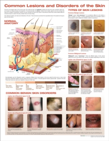 Common Lesions and Disorders of the Skin Anatomical Chart