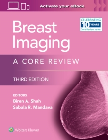 Breast Imaging : A Core Review