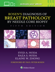 Rosen's Diagnosis of Breast Pathology by Needle Core Biopsy