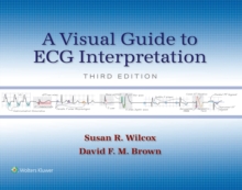 A Visual Guide to ECG Interpretation : eBook without Multimedia