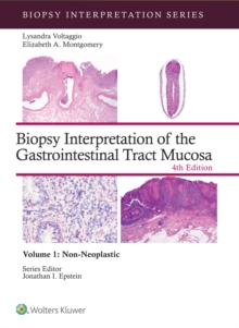 Biopsy Interpretation of the Gastrointestinal Tract Mucosa Volume 1 : Non-Neoplastic: eBook without Multimedia