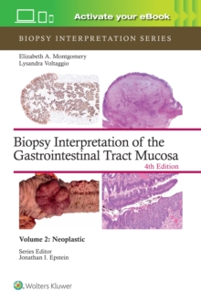 Biopsy Interpretation of the Gastrointestinal Tract Mucosa Volume 2 : Neoplastic: Print + eBook with Multimedia