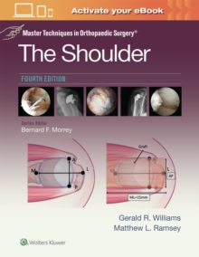 Wolters Kluwer Health Master Techniques In Orthopaedic Surgery, The Shoulder, Print + EBook With Multimedia
