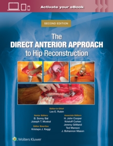 The Direct Anterior Approach to Hip Reconstruction