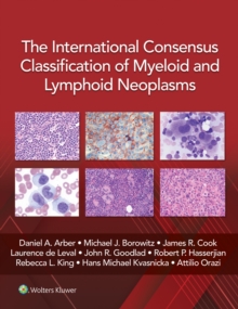 The International Consensus Classification Of Myeloid And Lymphoid Neoplasms\