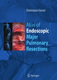 Atlas of endoscopic major pulmonary resections