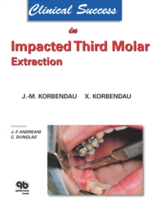 Clinical Success in Impacted Third Molar Extraction