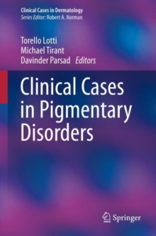 Clinical Cases in Pigmentary Disorders