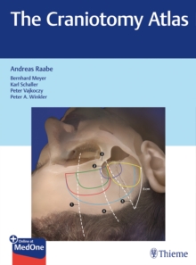 The Craniotomy Atlas, Hardback Book The Craniotomy Atlas, Hardback Book