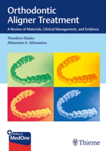 Orthodontic Aligner Treatment : A Review of Materials, Clinical Management, and Evidence