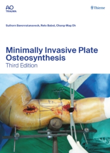 Minimally Invasive Plate Osteosynthesis