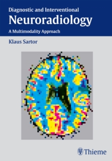 Diagnostic and Interventional Neuroradiology : A Multimodality Approach