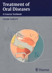 Treatment of Oral Diseases : A Concise Textbook