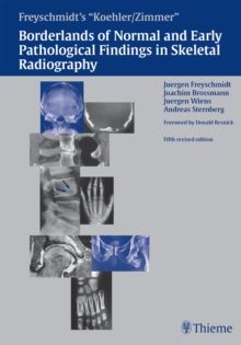 Freyschmidt's "Koehler/Zimmer" Borderlands of Normal and Early Pathological Findings in Skeletal Radiography