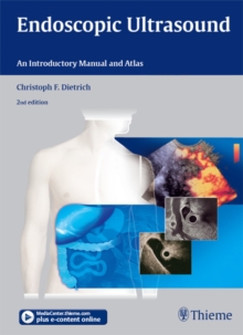 Endoscopic Ultrasound : An Introductory Manual and Atlas