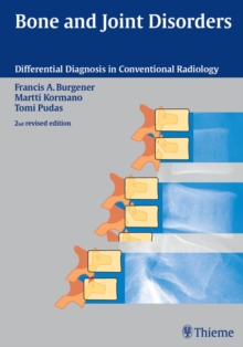 Bone and Joint Disorders