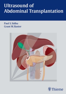 Ultrasound of Abdominal Transplantation