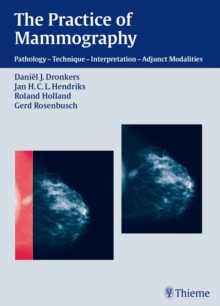 The Practice of Mammography : Pathology - Technique - Interpretation - Adjunct Modalities