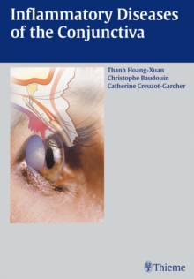 Inflammatory Diseases of the Conjuctiva