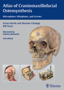 Atlas of Craniomaxillofacial Osteosynthesis : Microplates, Miniplates, and Screws