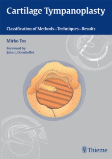 Cartilage Tympanoplasty : Classification of Methods - Techniques - Results