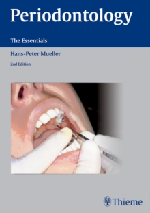 Periodontology : The Essentials