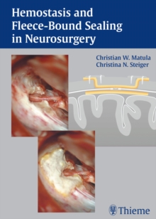 Hemostasis and Fleece-Bound Sealing in Neurosurgery