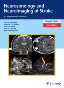 Neurosonology and Neuroimaging of Stroke : A Comprehensive Reference