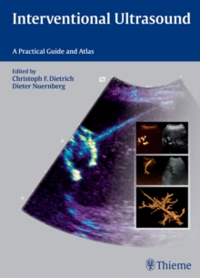 Interventional Ultrasound : A Practical Guide and Atlas